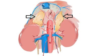 Adrenal (Böbreküstü Bezi)