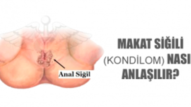 Anal Kondilom