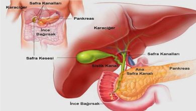 ANİ SANCILARIN NEDENİ SAFRA KESESİ TAŞLARI OLABİLİR