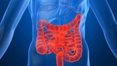 Crohn Hastalığı