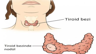 GUATR VE TROİD TİROİD NODÜLÜ