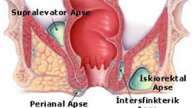 Perianal Apse