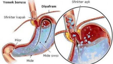 Reflü Nedir ve Nasıl Oluşur?
