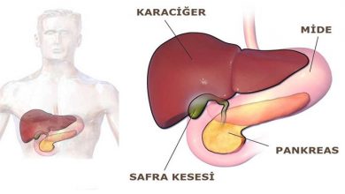 Safra Kesesi Taşı Ameliyatı (Yararları & Zararları)